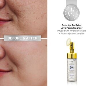 Gold and Clear Essential Purifying Cleanser